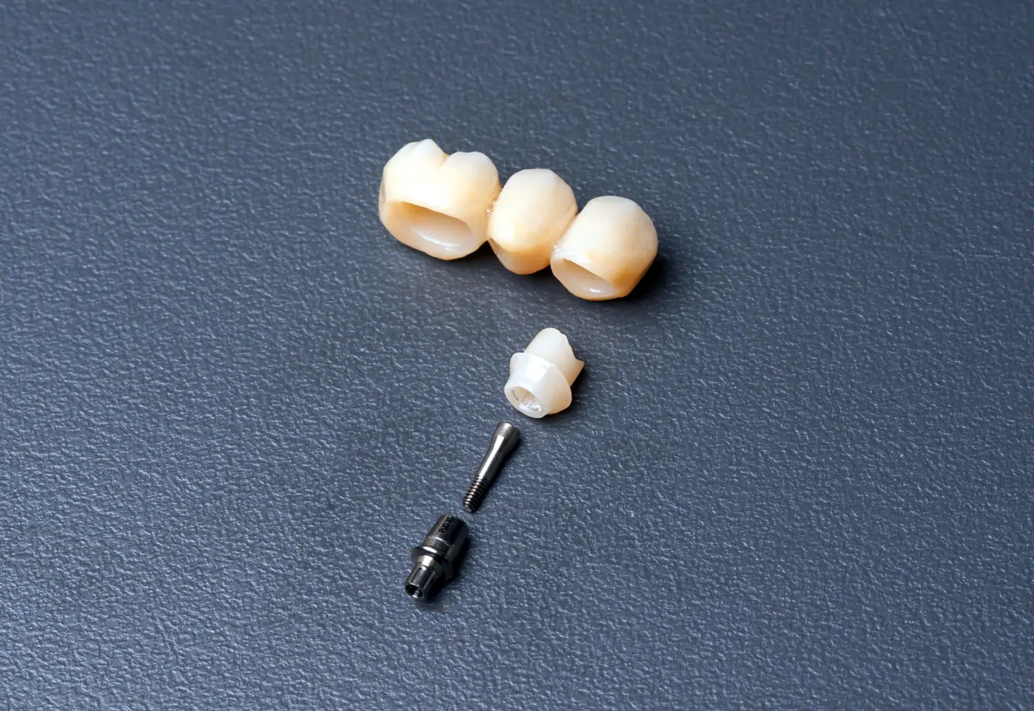 Implantat und Zahnkrone