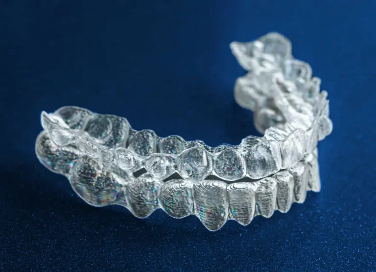 Invisalign Zahnspange