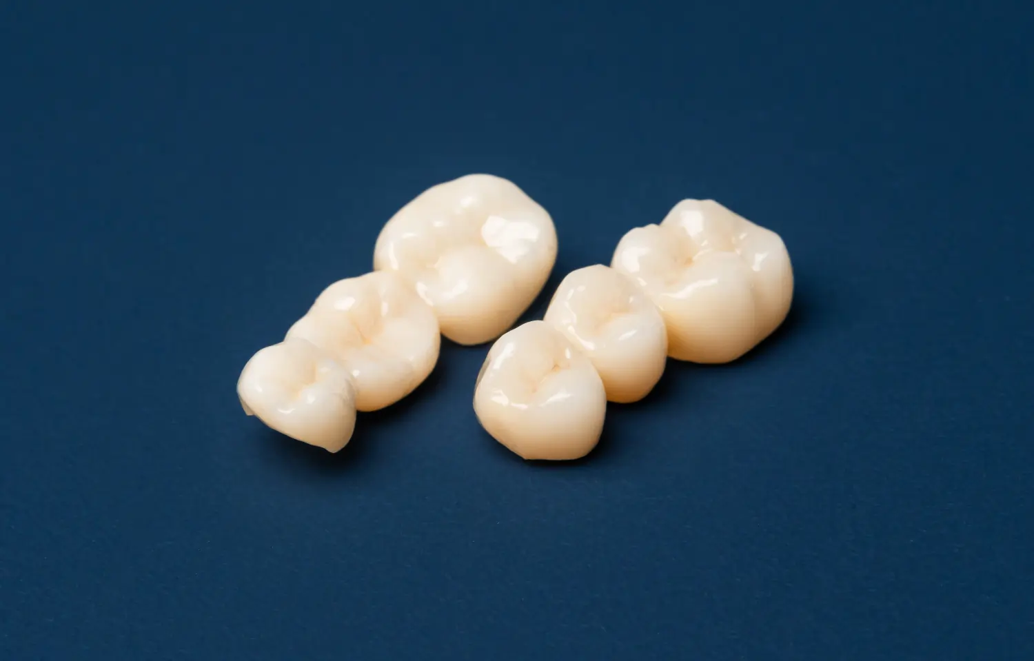 Zahnbrücken aus dem Dentalabor