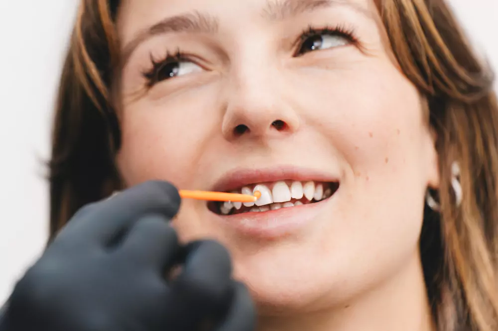 Veneers Behandlung